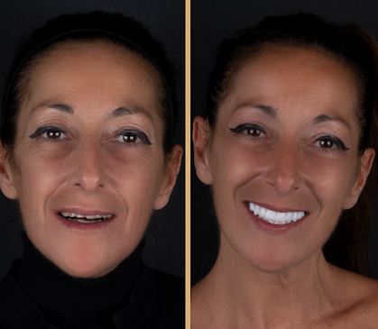 Slider image (3) Vitrin Plus Clinic